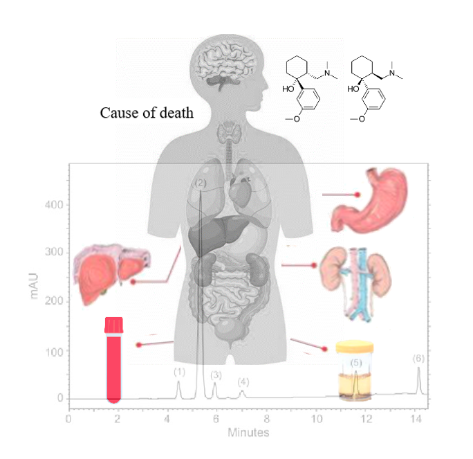 Graphical abstract of Sadeghi et al APH 2024;94:7-11